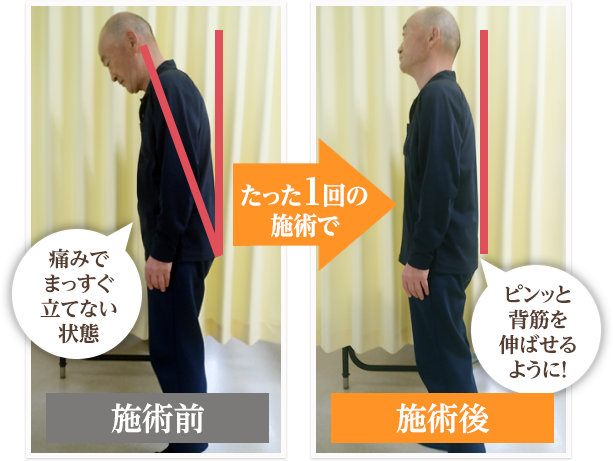 たった1回の施術で